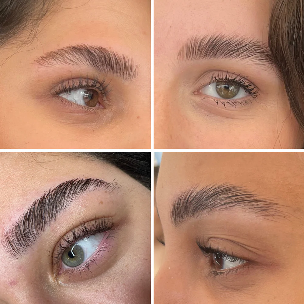 Brow-Lift Sourcils à Montpellier | Institut