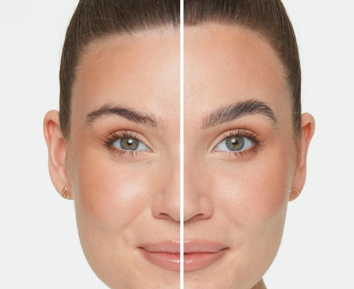 Brow-Lift Sourcils à Montpellier | Institut